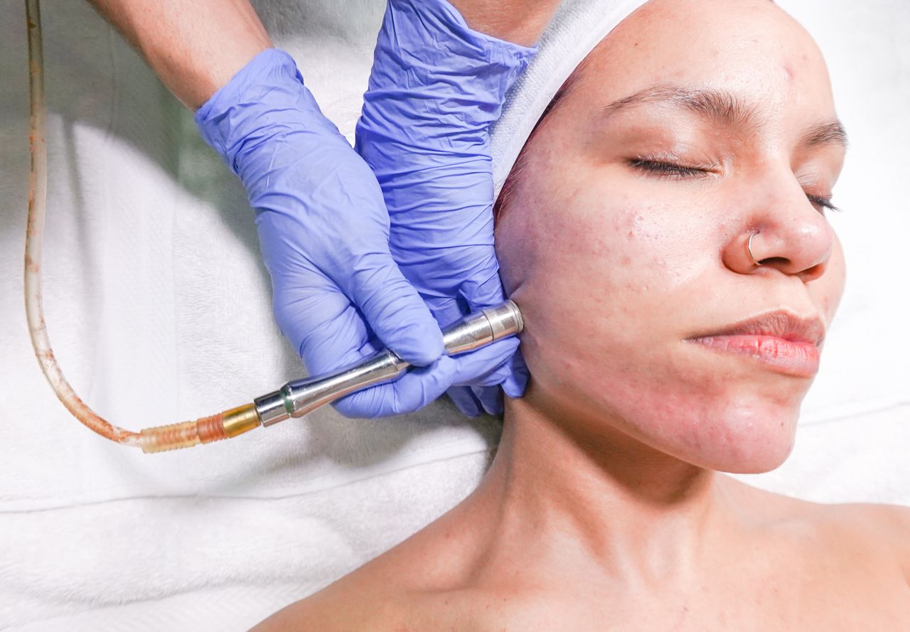 Home A woman receiving a microdermabrasion facial treatment by a professional with gloved hands.