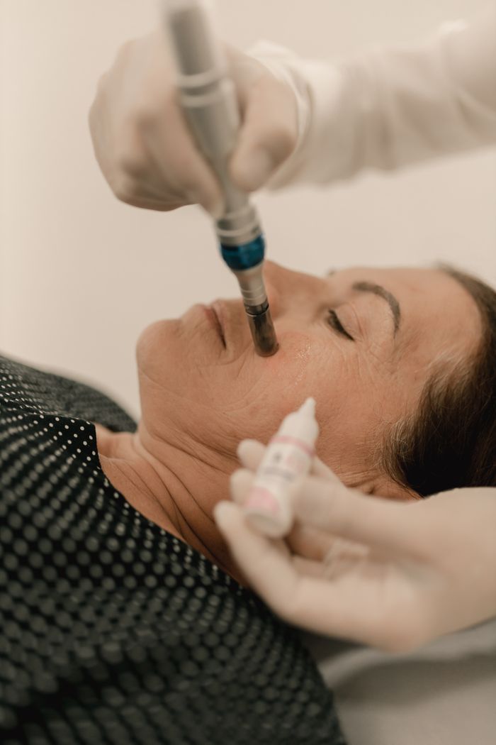 Home A woman receiving a facial microdermabrasion treatment in a spa setting.